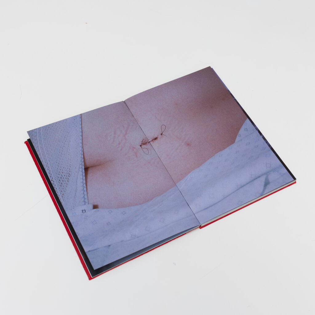 1.FERNANDAREQUENA_PAIN_INTERIOR3
